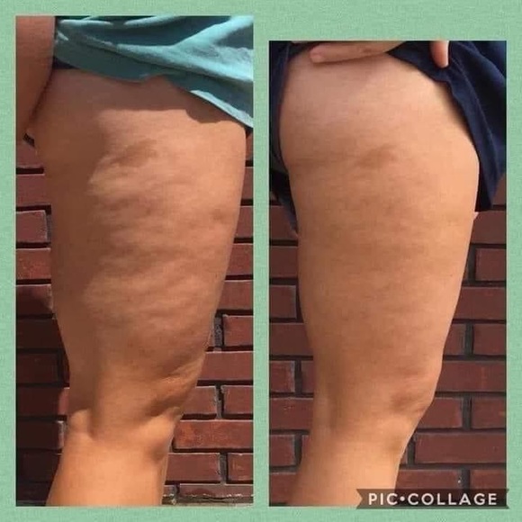 2 PACK ageLOC® Dermatic Effects™ Body Contouring Lotion - Picture 5 of 6